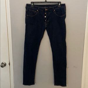 H&M Skinny’s